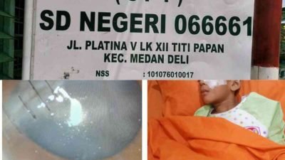 Guru SDN 066661 Diduga Lalai, Mata Murid Kelas 3 Terancam Buta Sebelah