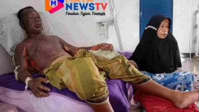 Tragis! Anak Bakar Ayah Kandung Gara-Gara Tak Dipinjami Handphone