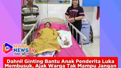 Dahnil Ginting Bantu Anak Penderita Luka Membusuk, Ajak Warga Tak Mampu Jangan Putus Asa