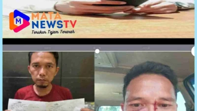 Warga Sei Mencirim Diduga Jadi Korban Penganiayaan Brutal, Pelaku Belum Ditahan Meski Sudah Dilaporkan